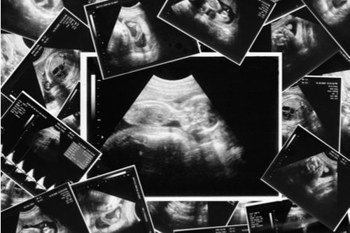 How Early Can You Experience Pregnancy Symptoms? Doctor